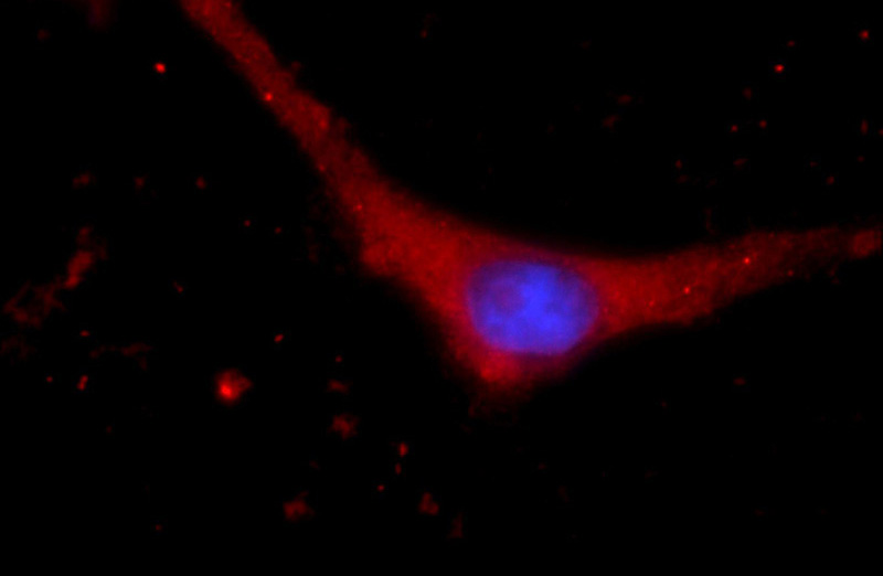 Immunofluorescent analysis of SH-SY5Y cells using Catalog No:111976(KCNN3 Antibody) at dilution of 1:25 and Rhodamine-Goat anti-Rabbit IgG