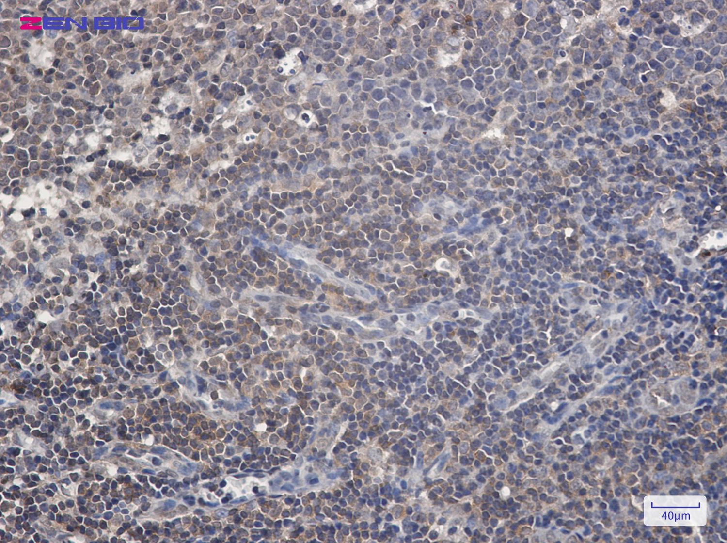 Immunohistochemistry of Raf1 (Phospho-Ser259) in paraffin-embedded Human tonsil using Raf1 (Phospho-Ser259) Rabbit pAb at dilution 1/20