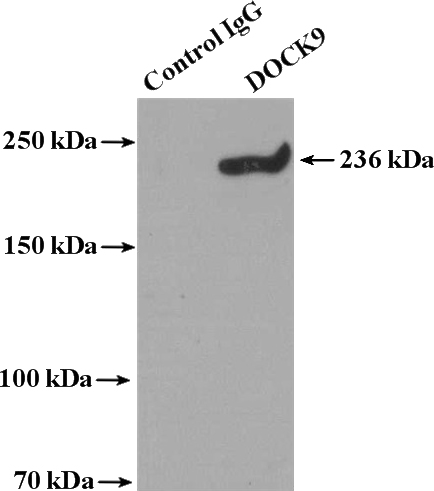 IP Result of anti-DocK9 (IP:Catalog No:110048, 4ug; Detection:Catalog No:110048 1:800) with mouse brain tissue lysate 4000ug.