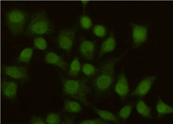 Immunocytochemistry staining of HeLa cells using anti-MSH2 antibody (dilution 1:100).