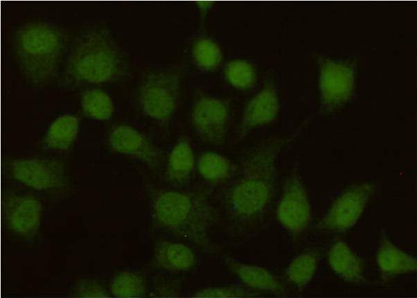 Immunocytochemistry staining of HeLa cells using anti-MSH2 antibody (dilution 1:100).