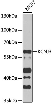 Western blot - KCNJ3 Polyclonal Antibody 