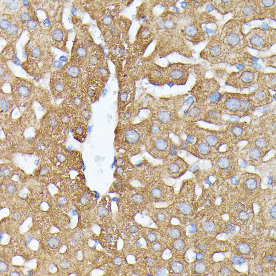 Immunohistochemistry - NUBP1 Polyclonal Antibody 