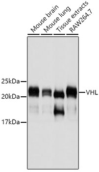 Western blot - VHL Monoclonal Antibody 