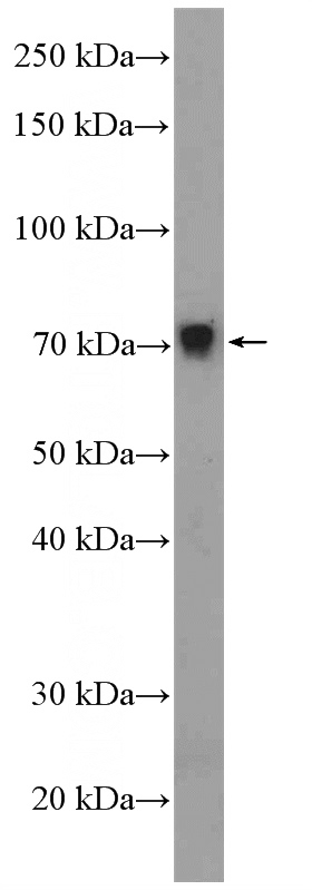 mouse liver tissue were subjected to SDS PAGE followed by western blot with Catalog No:117011(ZNF606 Antibody) at dilution of 1:600
