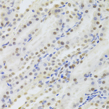 Immunohistochemistry - HDGF Polyclonal Antibody 