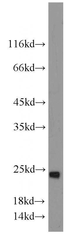 HepG2 cells were subjected to SDS PAGE followed by western blot with Catalog No:115065(SAR1A antibody) at dilution of 1:500