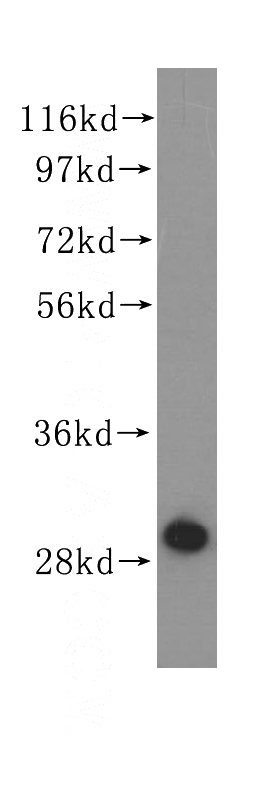 human liver tissue were subjected to SDS PAGE followed by western blot with Catalog No:110293(ECHS1 antibody) at dilution of 1:1200