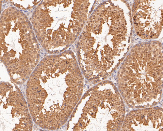 Fig4:; Immunohistochemical analysis of paraffin-embedded mouse testis tissue using anti-TMX4 antibody. The section was pre-treated using heat mediated antigen retrieval with sodium citrate buffer (pH 6.0) for 20 minutes. The tissues were blocked in 5% BSA for 30 minutes at room temperature, washed with ddH; 2; O and PBS, and then probed with the primary antibody ( 1/400) for 30 minutes at room temperature. The detection was performed using an HRP conjugated compact polymer system. DAB was used as the chromogen. Tissues were counterstained with hematoxylin and mounted with DPX.