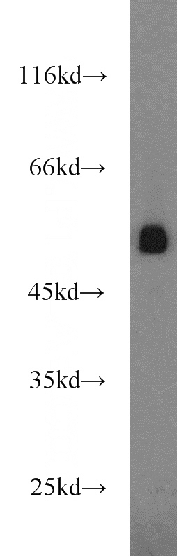 human brain tissue were subjected to SDS PAGE followed by western blot with Catalog No:111136(GPR83 antibody) at dilution of 1:1000