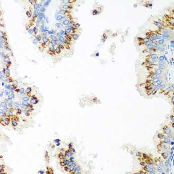 Immunohistochemistry - UBIAD1 Polyclonal Antibody 