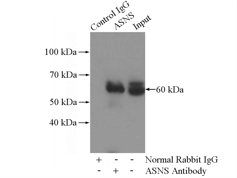 IP Result of anti-ASNS (IP:Catalog No:108234, 4ug; Detection:Catalog No:108234 1:500) with HeLa cells lysate 1200ug.