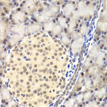 Immunohistochemistry - PAWR Polyclonal Antibody 
