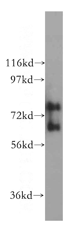 HEK-293 cells were subjected to SDS PAGE followed by western blot with Catalog No:113429(OSBPL10 antibody) at dilution of 1:400