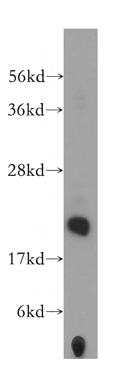 HepG2 cells were subjected to SDS PAGE followed by western blot with Catalog No:114031(PMVK antibody) at dilution of 1:500
