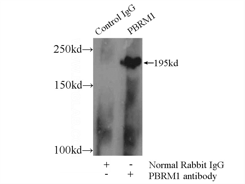 IP Result of anti-PBRM1 (IP:Catalog No:113613, 3ug; Detection:Catalog No:113613 1:300) with HEK-293 cells lysate 1800ug.