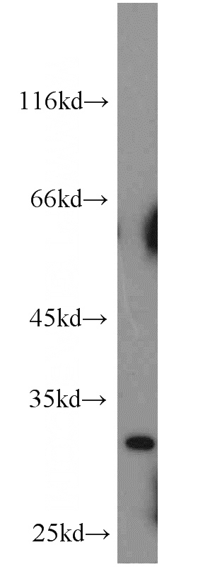 mouse heart tissue were subjected to SDS PAGE followed by western blot with Catalog No:112489(CMA1 antibody) at dilution of 1:500