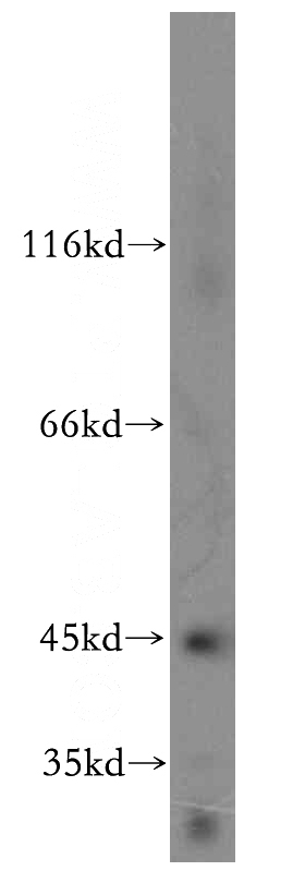 mouse heart tissue were subjected to SDS PAGE followed by western blot with Catalog No:107792(ADHFE1 antibody) at dilution of 1:1000