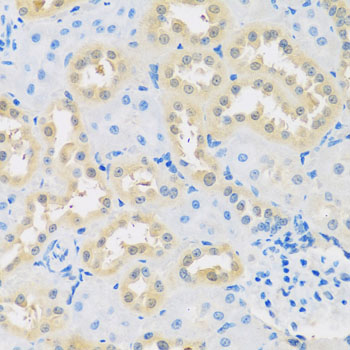 Immunohistochemistry - LETMD1 Polyclonal Antibody 