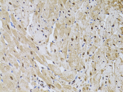 Immunohistochemistry - HUS1 Polyclonal Antibody 