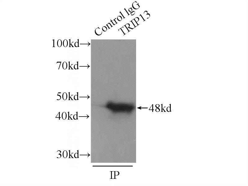 IP Result of anti-TRIP13 (IP:Catalog No:116327, 3ug; Detection:Catalog No:116327 1:400) with mouse testis tissue lysate 6000ug.