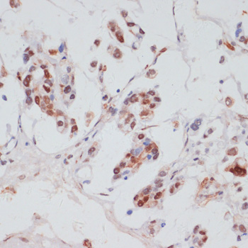 Immunohistochemistry - Phospho-PEA15-S104 pAb 