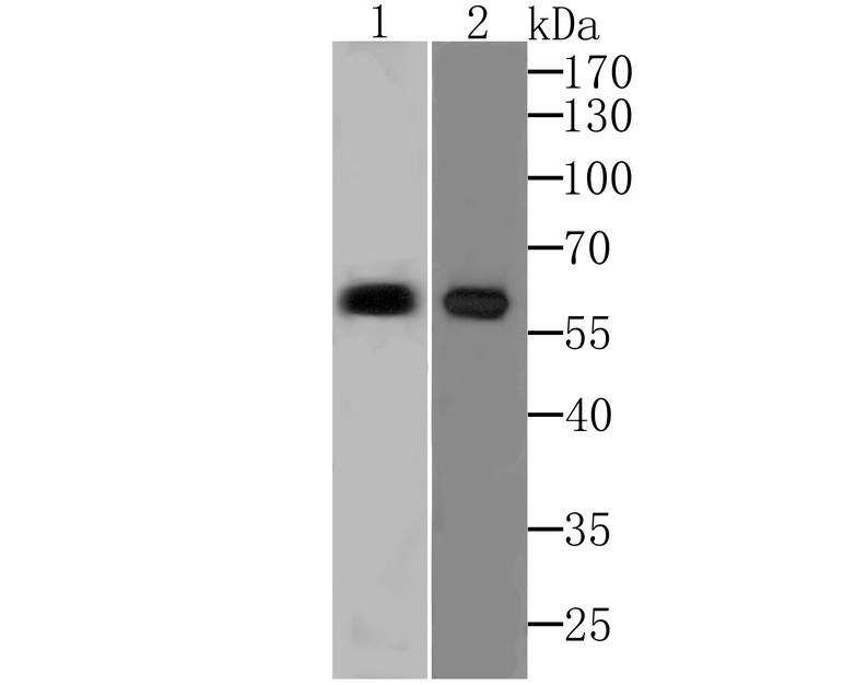 Fig1: Western blot analysis of PARP2 on SiHa and Raji cell lysates using anti-PARP2 at 1/500 dilution.