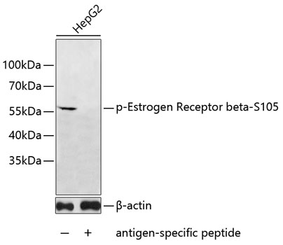 Western blot - Phospho-Estrogen Receptor beta-S105 pAb 