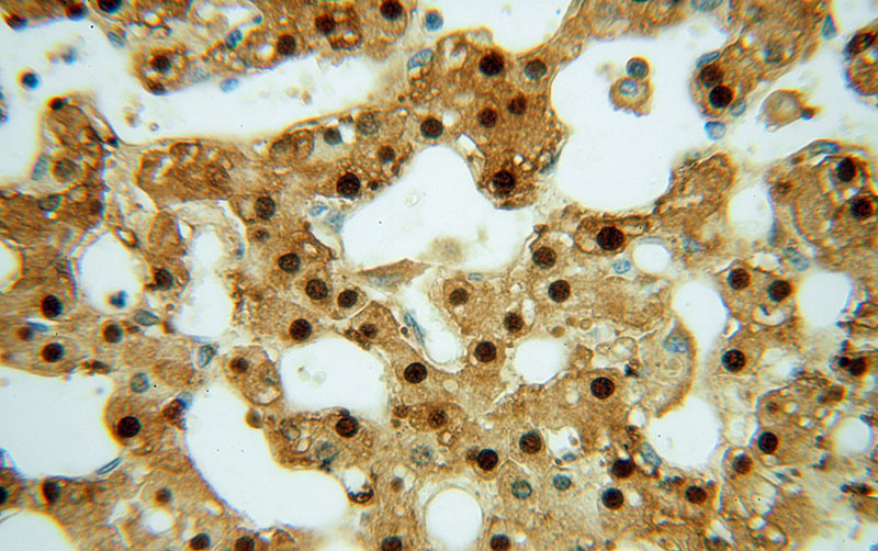 Immunohistochemical of paraffin-embedded human liver using Catalog No:112248(ARG1 antibody) at dilution of 1:50 (under 40x lens)