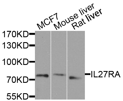 Western blot - IL27RA Polyclonal Antibody 