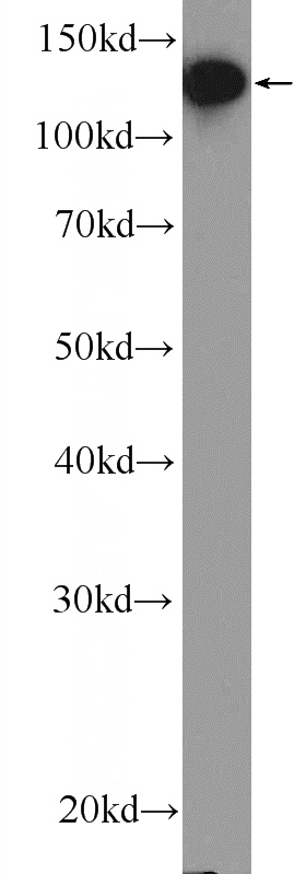 HEK-293 cells were subjected to SDS PAGE followed by western blot with Catalog No:114232(PRPF40A Antibody) at dilution of 1:1000