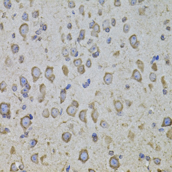 Immunohistochemistry - CRHR1 Polyclonal Antibody 