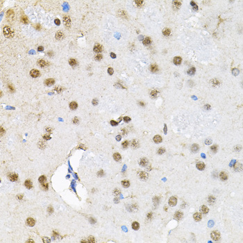 Immunohistochemistry - BAF60a Polyclonal Antibody 
