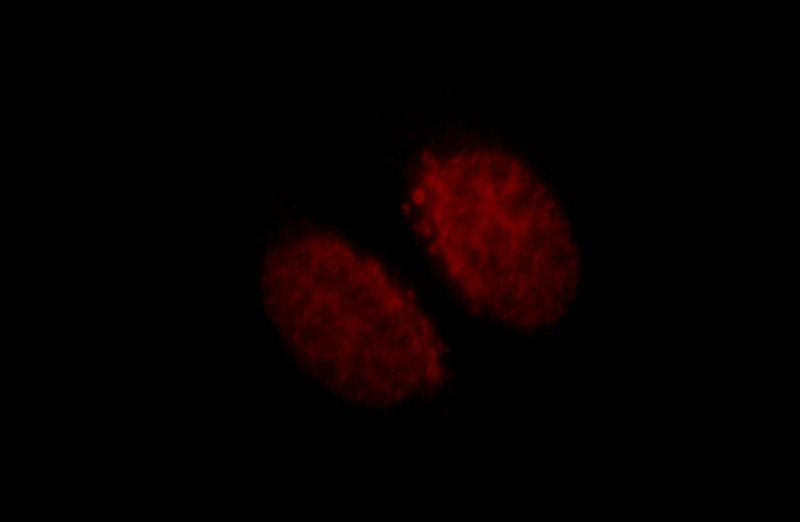 Immunofluorescent analysis of HepG2 cells, using CUX1 antibody Catalog No:109628 at 1:25 dilution and Rhodamine-labeled goat anti-rabbit IgG (red).