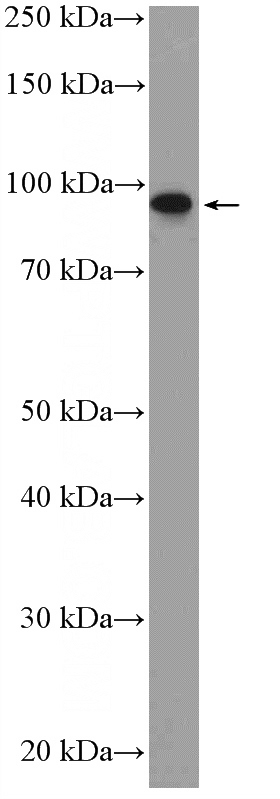 HeLa cells were subjected to SDS PAGE followed by western blot with Catalog No:113885(PIBF1 Antibody) at dilution of 1:1000