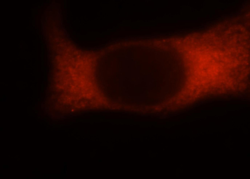 Immunofluorescent analysis of MCF-7 cells, using RPS16 antibody Catalog No:114831 at 1:25 dilution and Rhodamine-labeled goat anti-rabbit IgG (red).