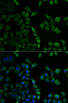 Immunofluorescence - MSLN Polyclonal Antibody 