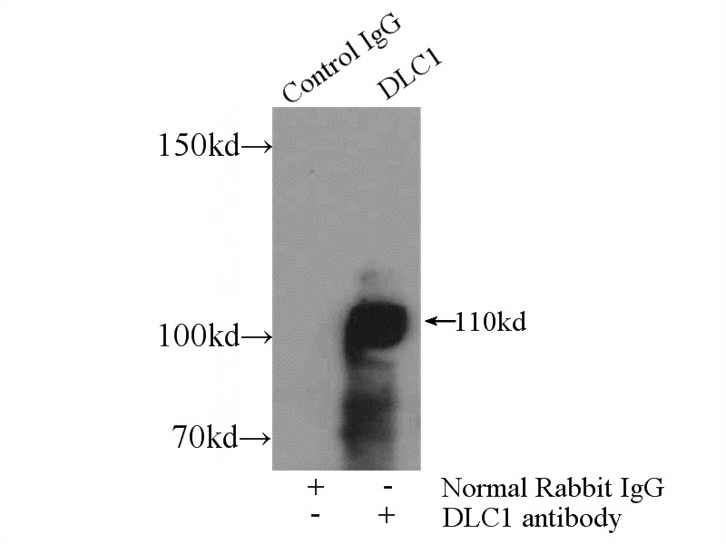 IP Result of anti-DLC1 (IP:Catalog No:109986, 4ug; Detection:Catalog No:109986 1:300) with mouse lung tissue lysate 2400ug.