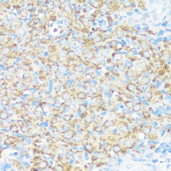 Immunohistochemistry - NMT1 Polyclonal Antibody 