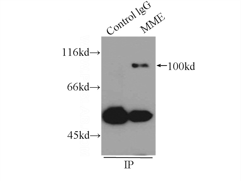 IP Result of anti-MME,CD10 (IP:Catalog No:112695, 3ug; Detection:Catalog No:112695 1:500) with Raji cells lysate 2400ug.