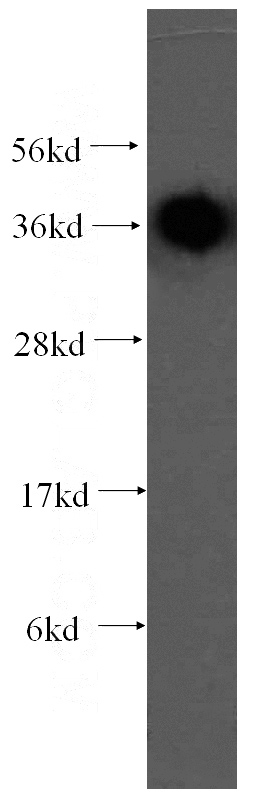 human heart tissue were subjected to SDS PAGE followed by western blot with Catalog No:114669(RDH13 antibody) at dilution of 1:500