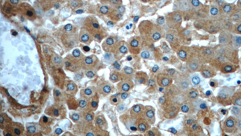 Immunohistochemistry of paraffin-embedded human liver slide using Catalog No:107581(A2M Antibody) at dilution of 1:50