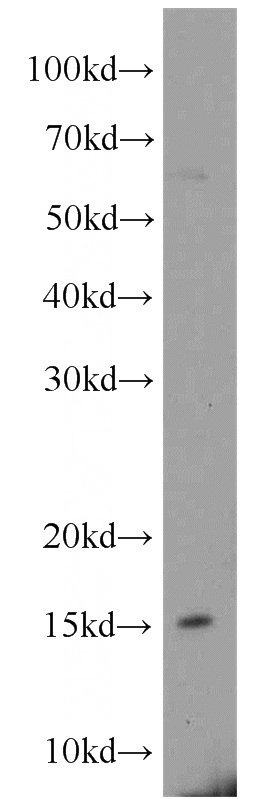 mouse spleen tissue were subjected to SDS PAGE followed by western blot with Catalog No:110599(FAM72A antibody) at dilution of 1:800