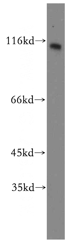 Y79 cells were subjected to SDS PAGE followed by western blot with Catalog No:109050(PROM1-1,2,3,5,7 antibody) at dilution of 1:100