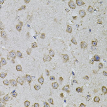 Immunohistochemistry - TRPC3 Polyclonal Antibody 