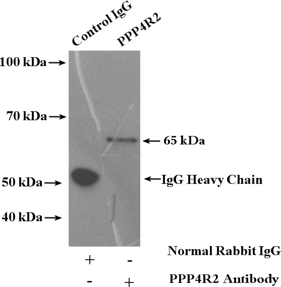 IP Result of anti-PPP4R2 (IP:Catalog No:114117, 4ug; Detection:Catalog No:114117 1:1000) with HepG2 cells lysate 3600ug.