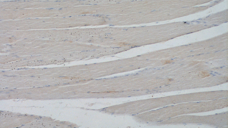 Immunohistochemistry of paraffin-embedded human skeletal muscle tissue slide using Catalog No:112994(MYOM3 Antibody) at dilution of 1:200 (under 10x lens).