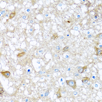 Immunohistochemistry - BMP5 Polyclonal Antibody 