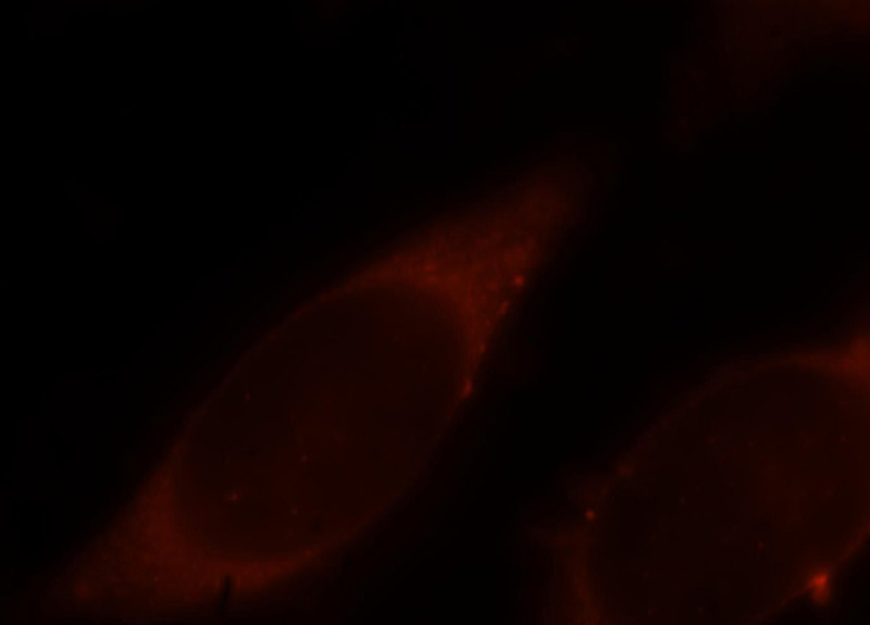 Immunofluorescent analysis of Hela cells, using ARPC2 antibody Catalog No:108165 at 1:25 dilution and Rhodamine-labeled goat anti-rabbit IgG (red).