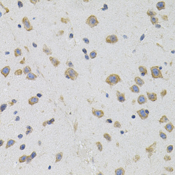 Immunohistochemistry - SIGMAR1 Polyclonal Antibody 